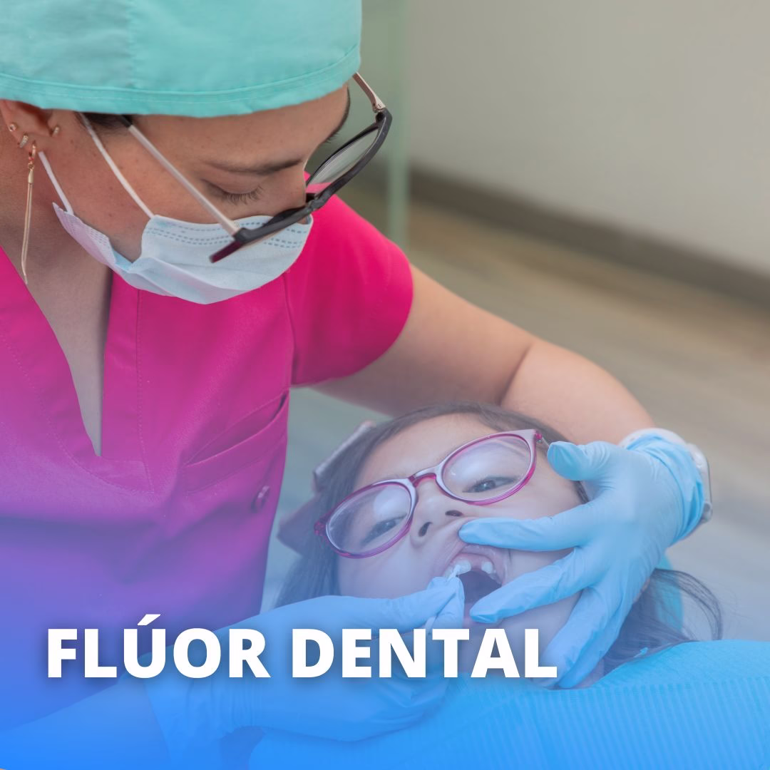fluor dental precio chile