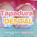 oferta y promocion de tapadura estetica blanca dental