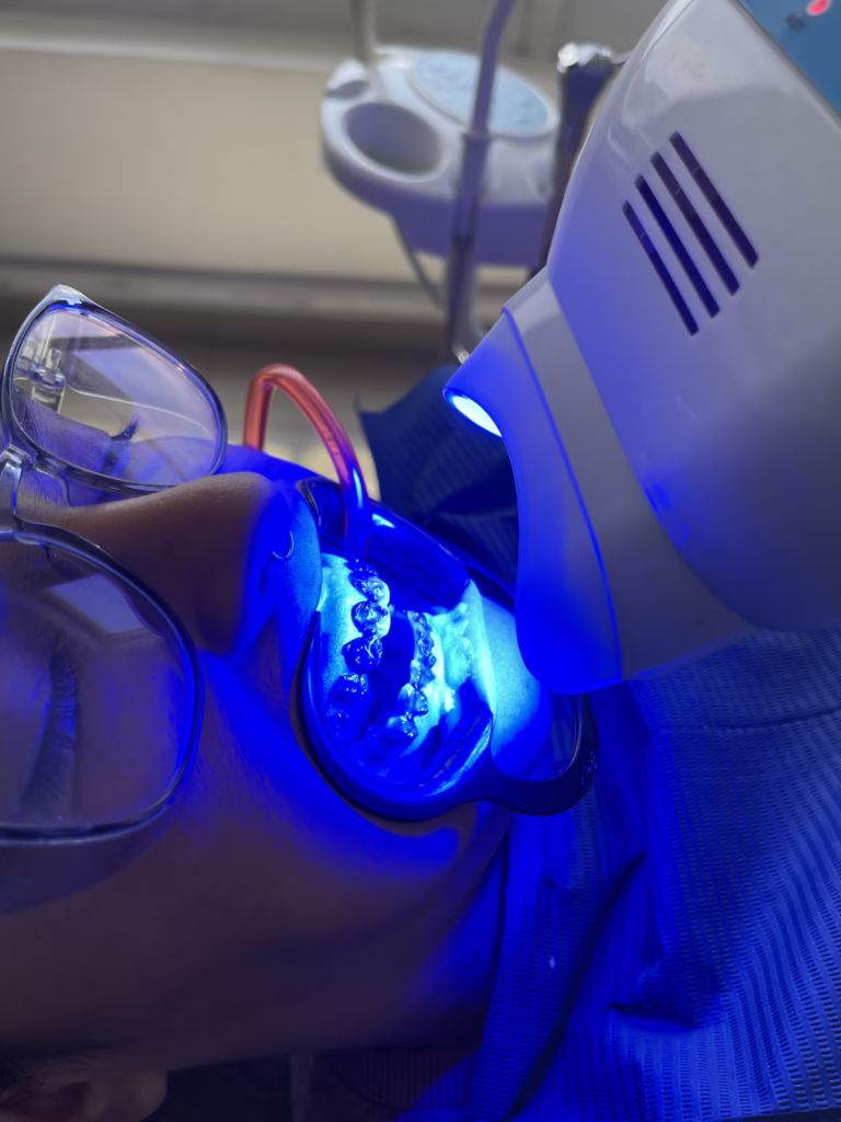 blanqueamiento dental laser
