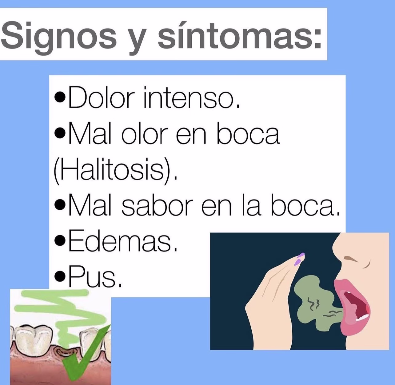 signos y sintomas de alveolitis dental
