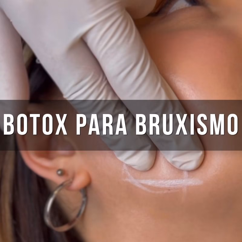 servicio dental botox para no bruxar