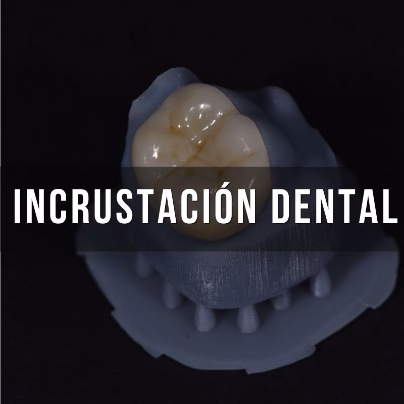 servicio de incrutaciones dentales