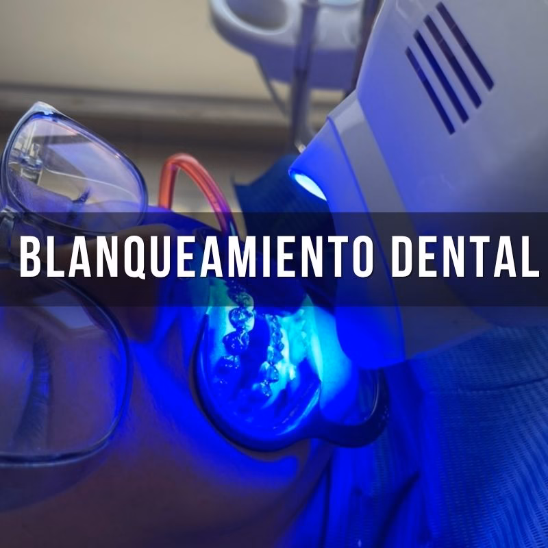 servicio de aclaramiento dental
