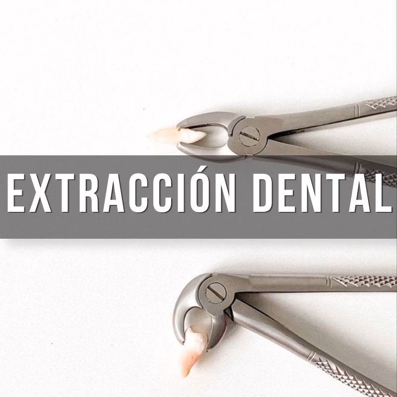 servicio de extracciones dentales simples