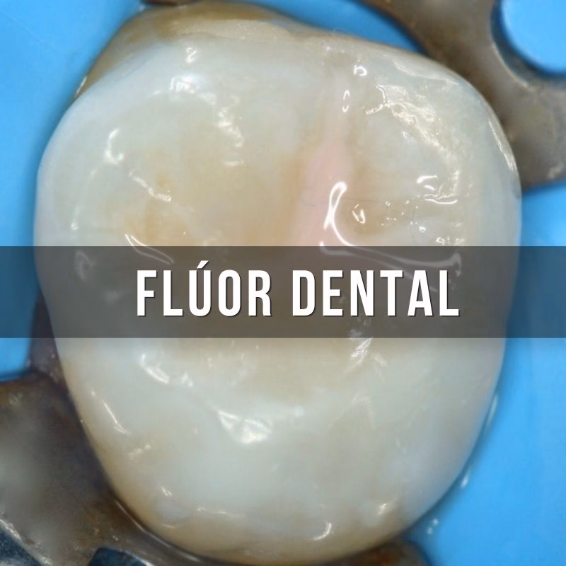 servicio de fluoracion