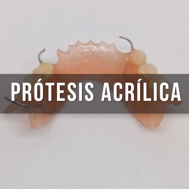 servicio dental de placa acrilica