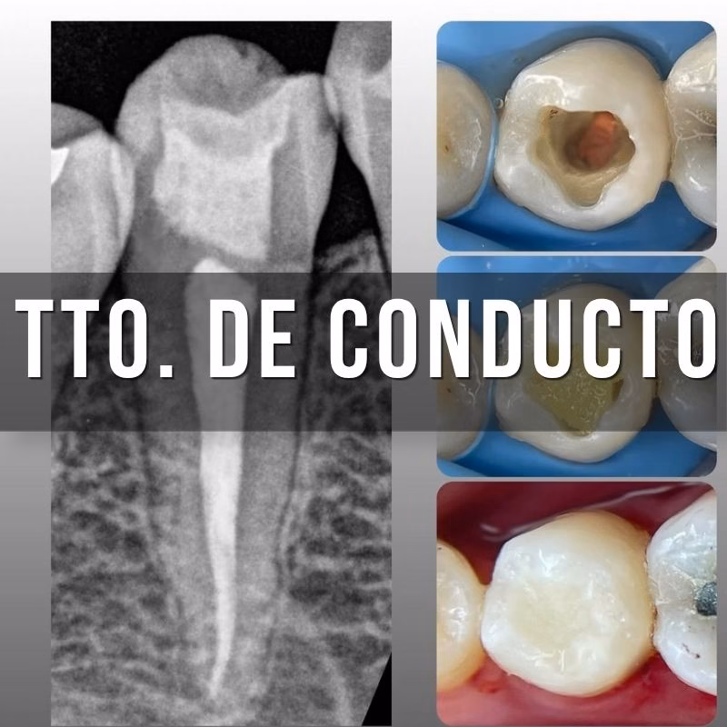 servicio de endodoncia