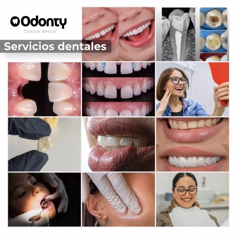 servicio dental en santiago de Chile