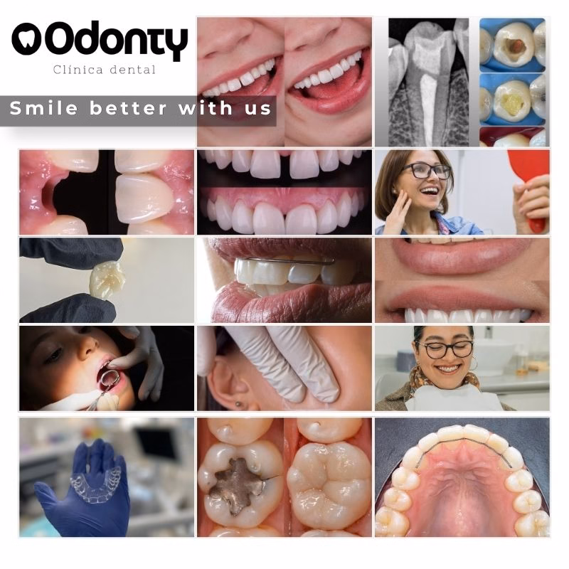 Odonty | dentista en santiago