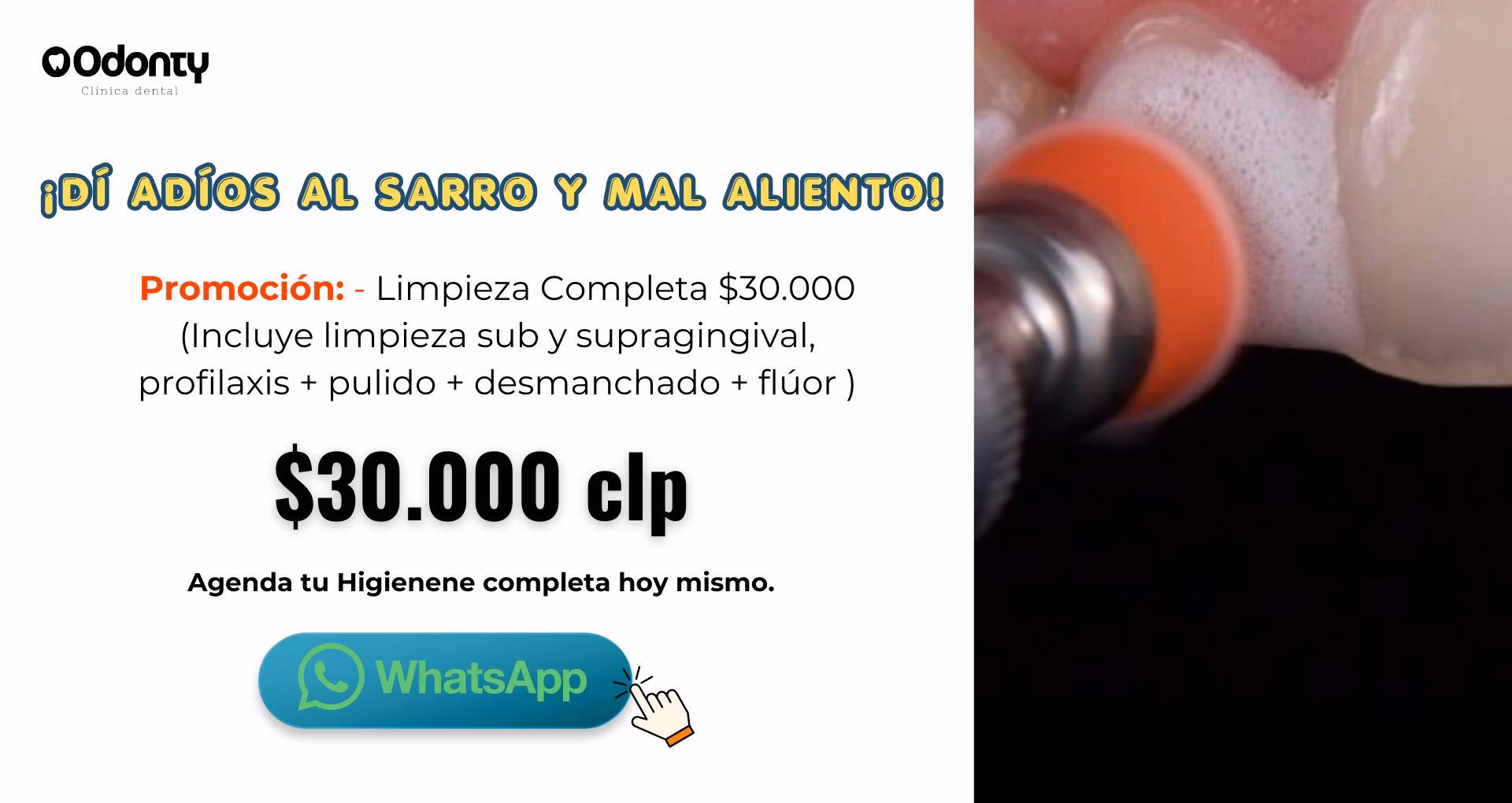 promocion de limpieza dental precio en santiago de chile