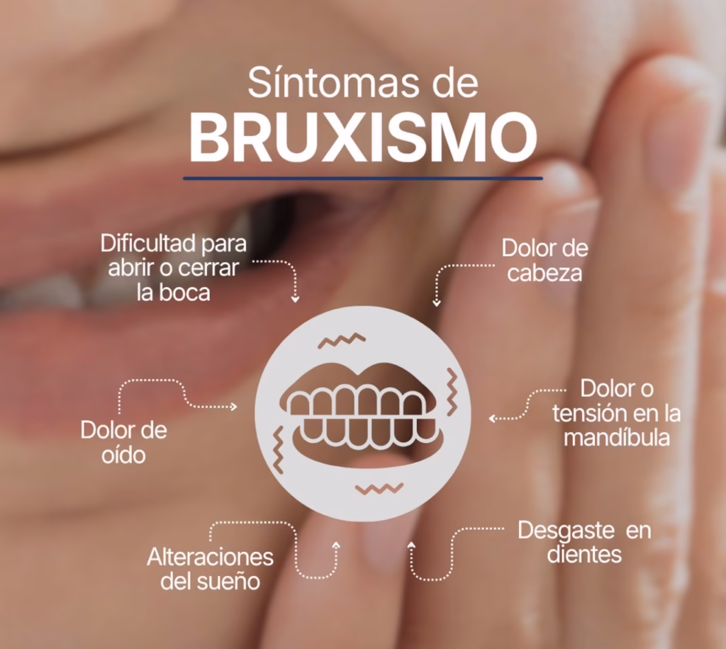 signos y sintomas de bruxismo
