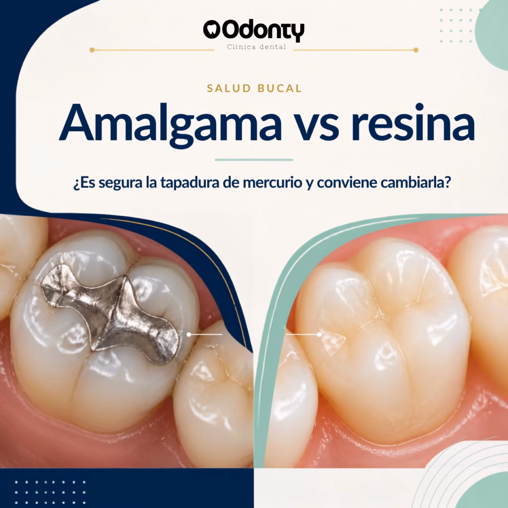 que es mejor resina o amalgama dental.