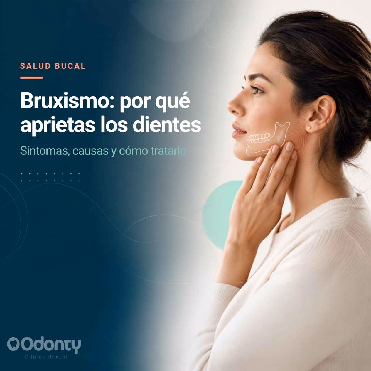 Bruxismo: por qué aprietas los dientes, síntomas y tratamiento