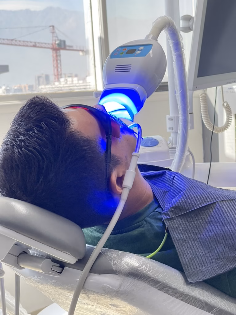 paciente realizandose blanqueamiento en clinica dental en santiago de chile odonty
