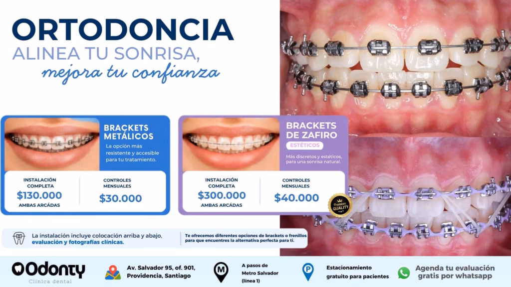 valor de brackets